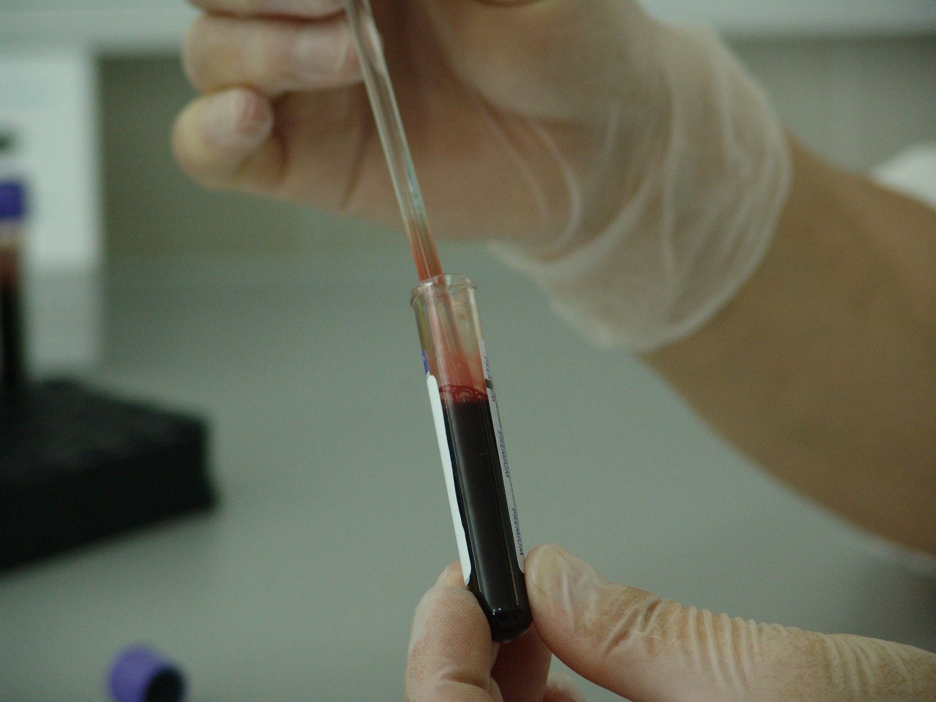 04422722-c9c5-11e9-b2f7-0242ac110003-blood-20745_1920.jpg