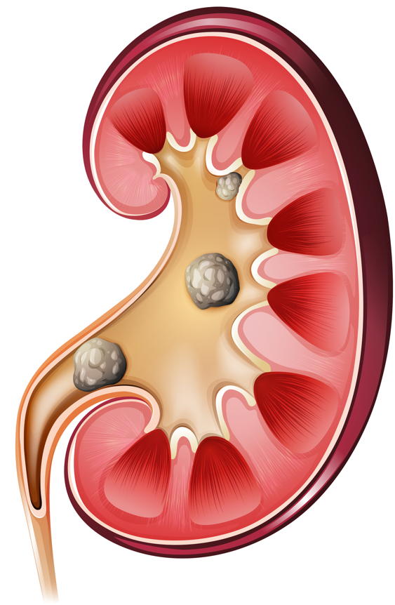 renal.png