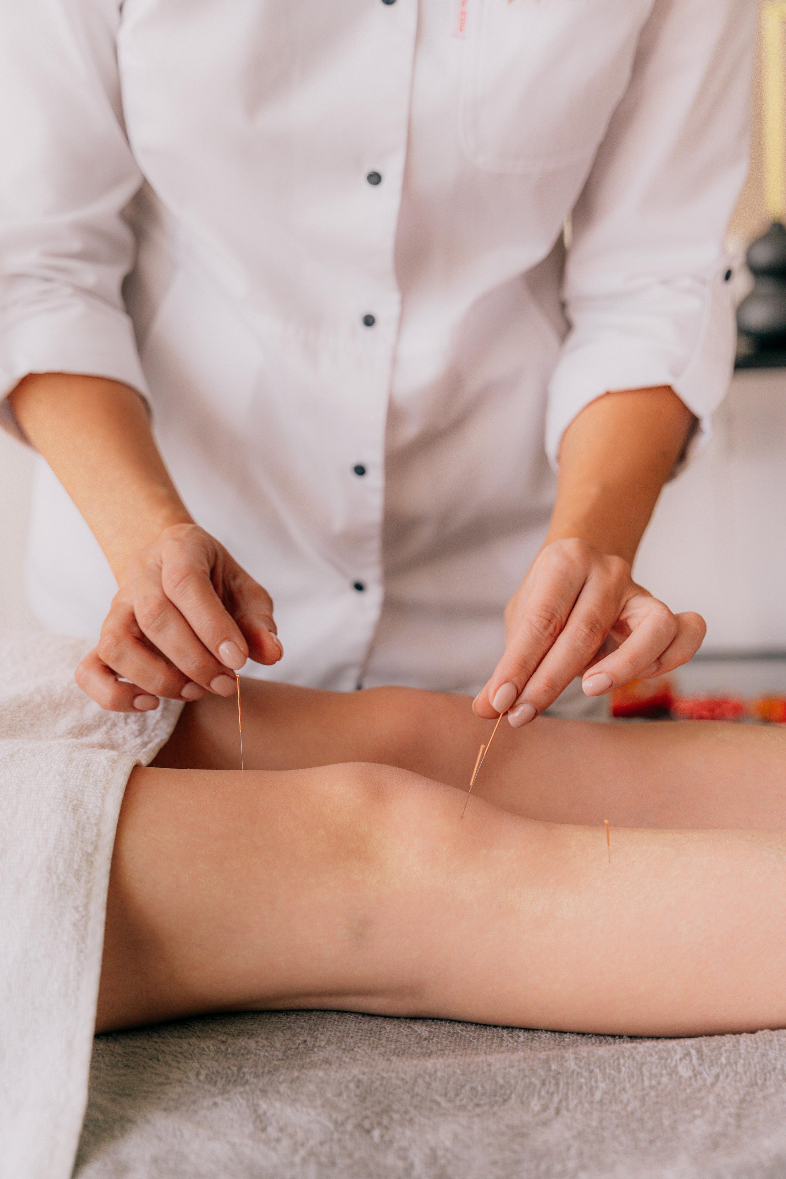 Lesser-known conditions holistic acupuncture arts can help