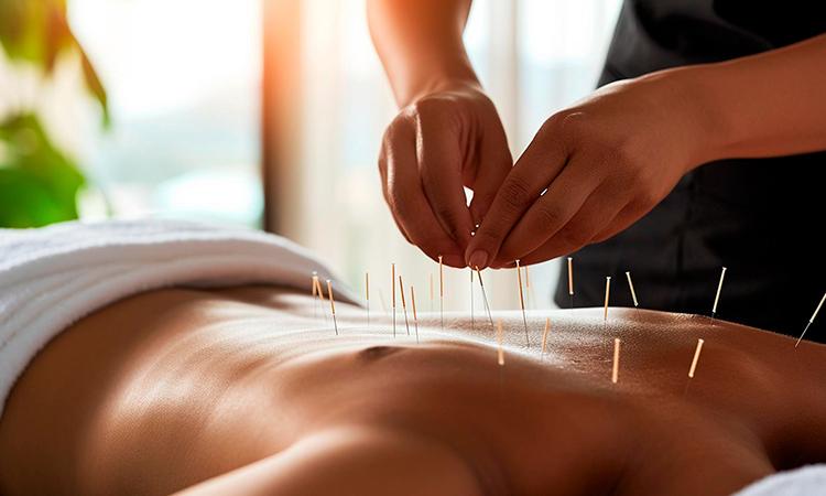 Mar Accupuncture-What to Expect in Your First Acupuncture Session in-St Petersberg Florida