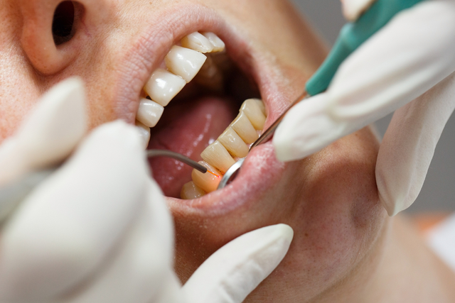laser gum surgery arlington va.jpg