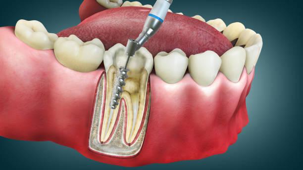 istockphoto-1543511026-612x612.jpg