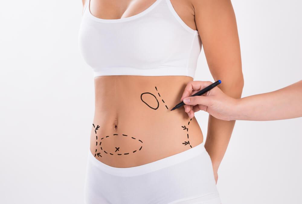 how liposuction in dubai can affect your psychological well-being.jpg