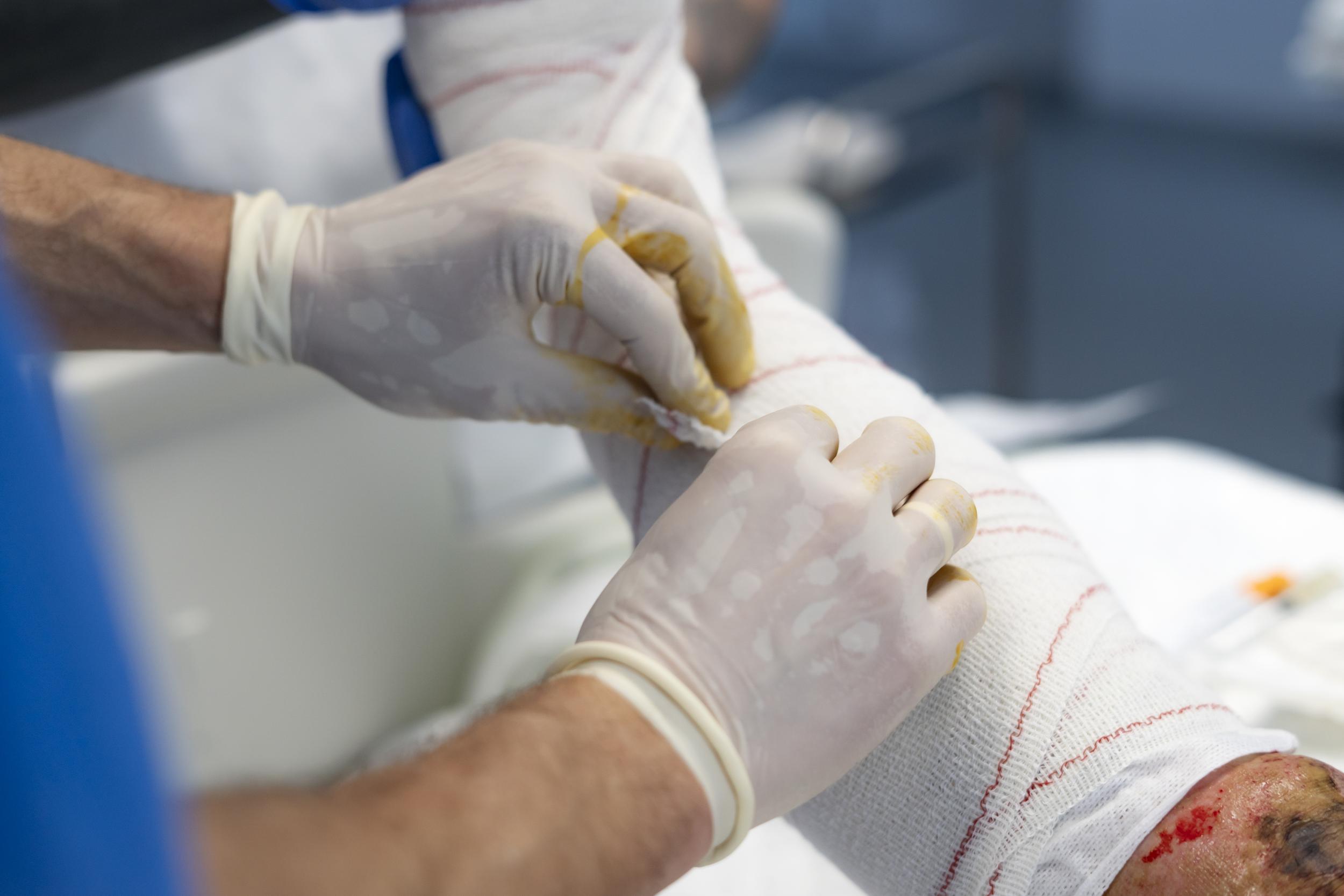 doctors-applying-bandage-on-injured-leg-in-operati-2025-04-07-20-02-55-utc.jpg