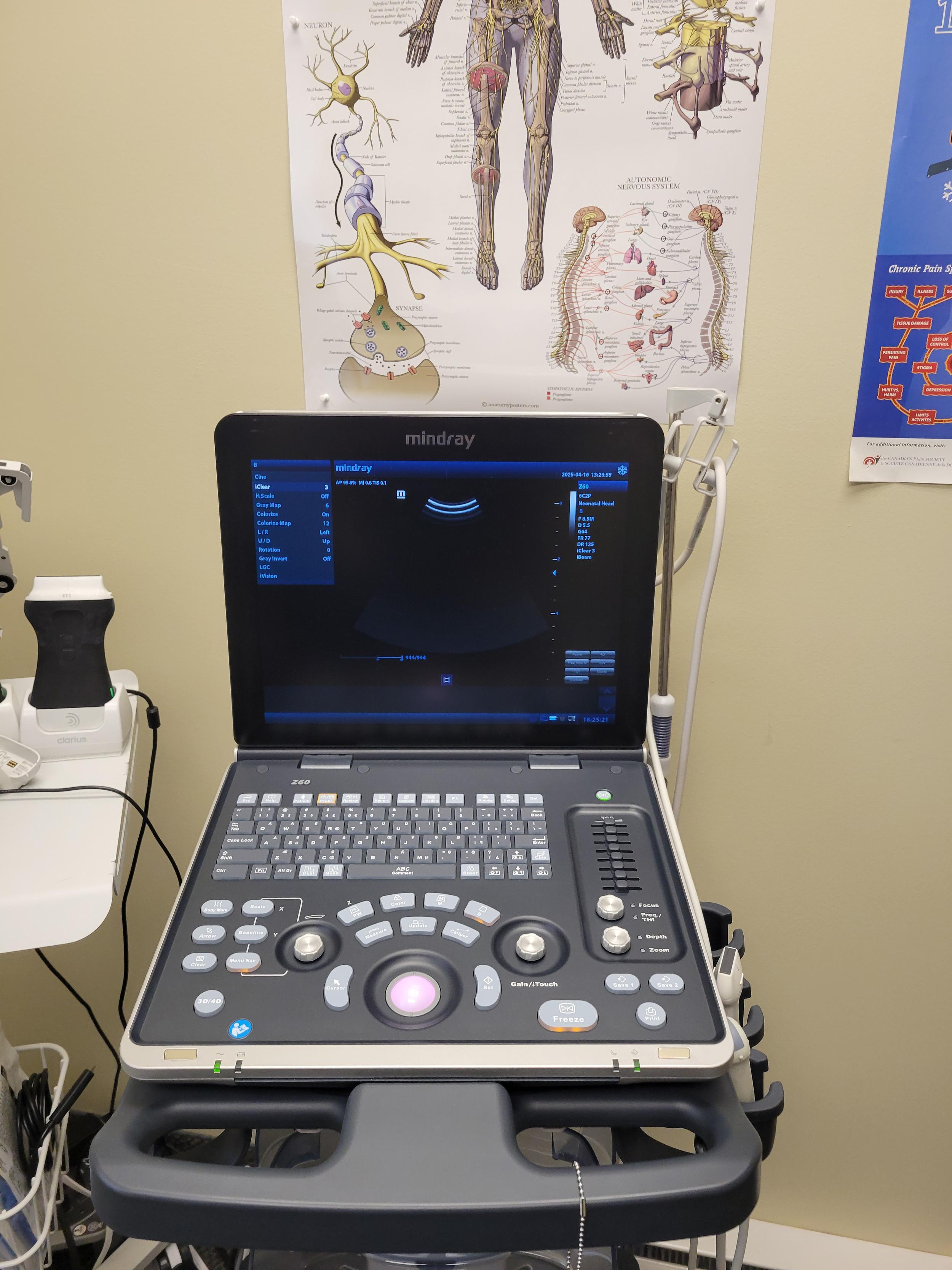 mindray ultrasound.jpg