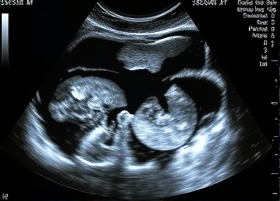 Advanced pregnancy ultrasound imaging