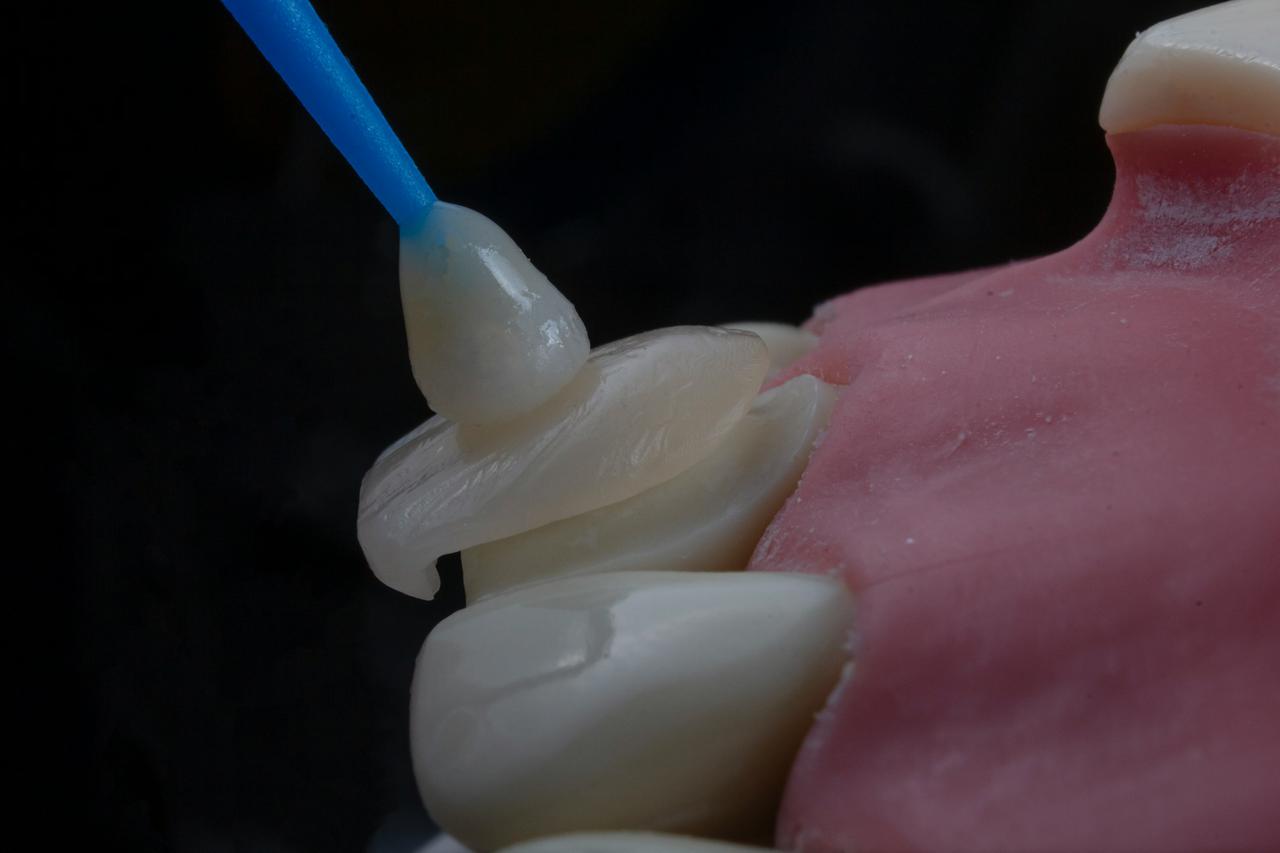 Cosmetic dentistry