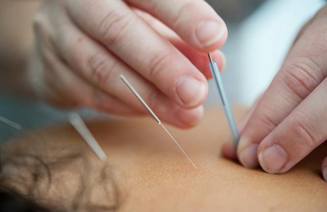 <strong>How can Acupuncture be Implemented for Back Pain</strong>