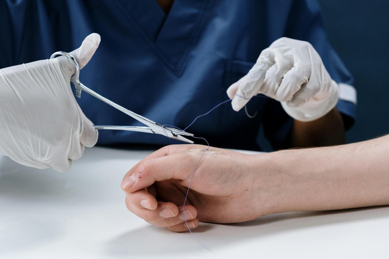 A healthcare professional carefully suturing a hand, showcasing precision in medical care.