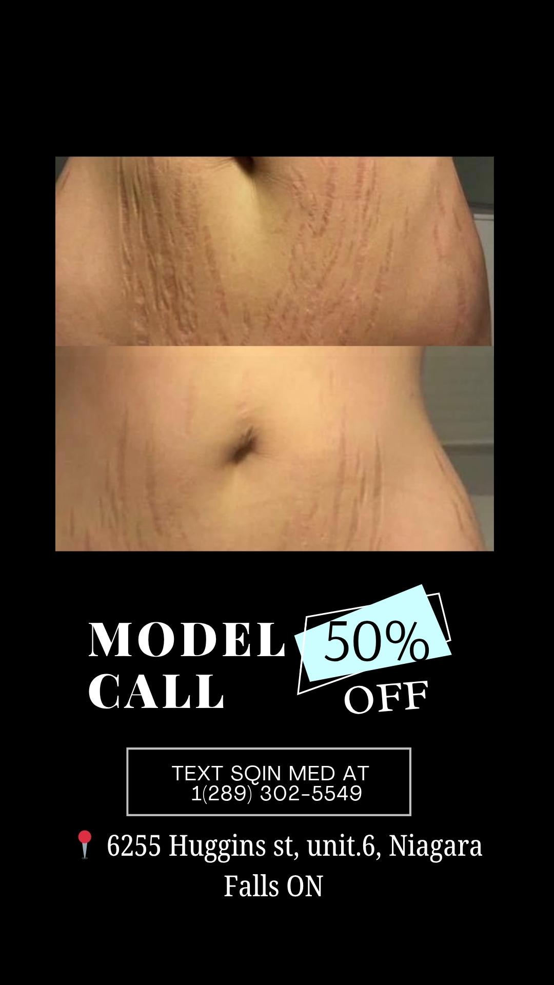 effectively reduce hypertrophic scars (3).jpg