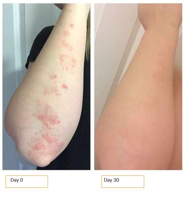 arm skinade before and after