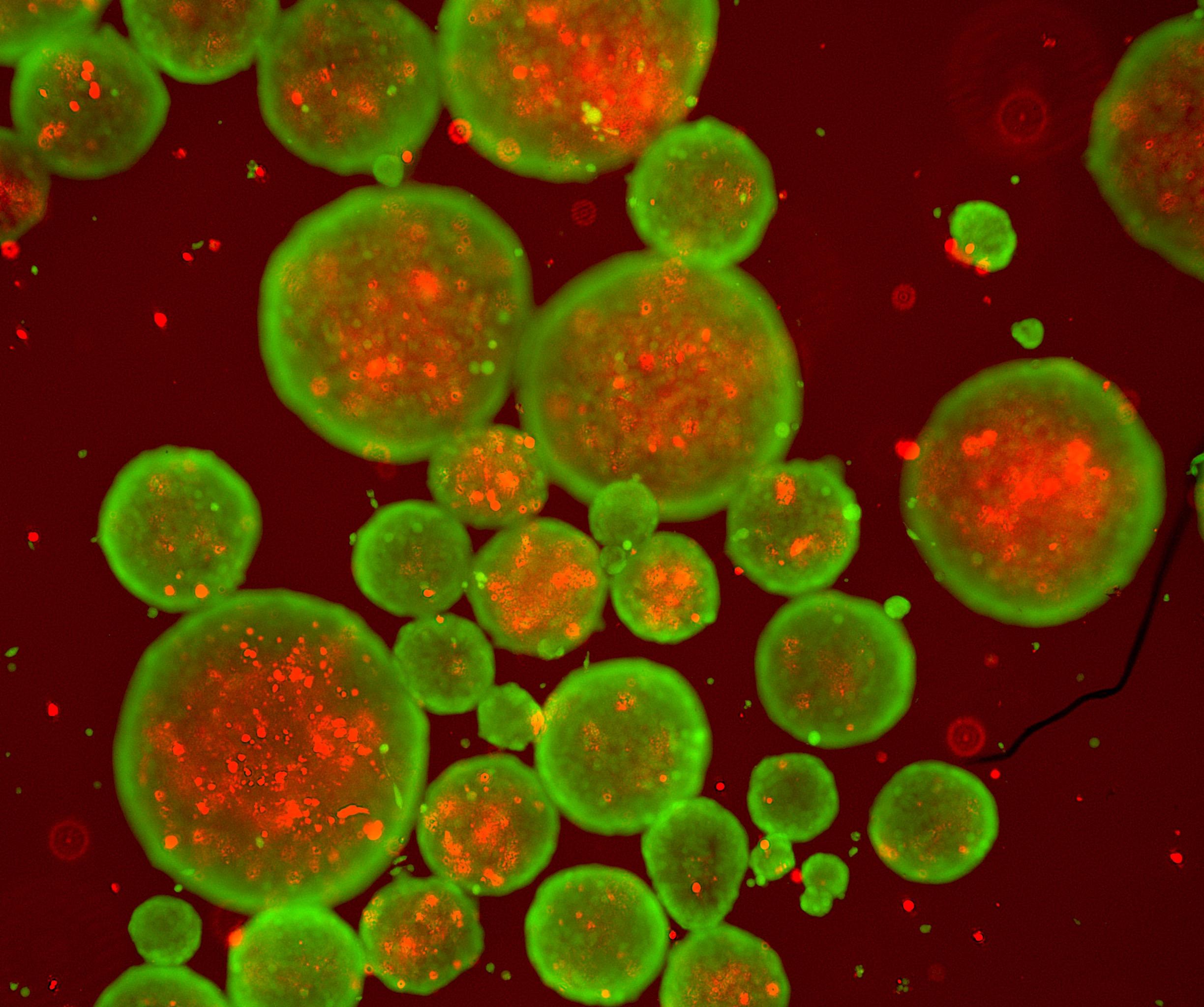 lp74 nts-plustfgb2-2of2_0011_overlay.jpg