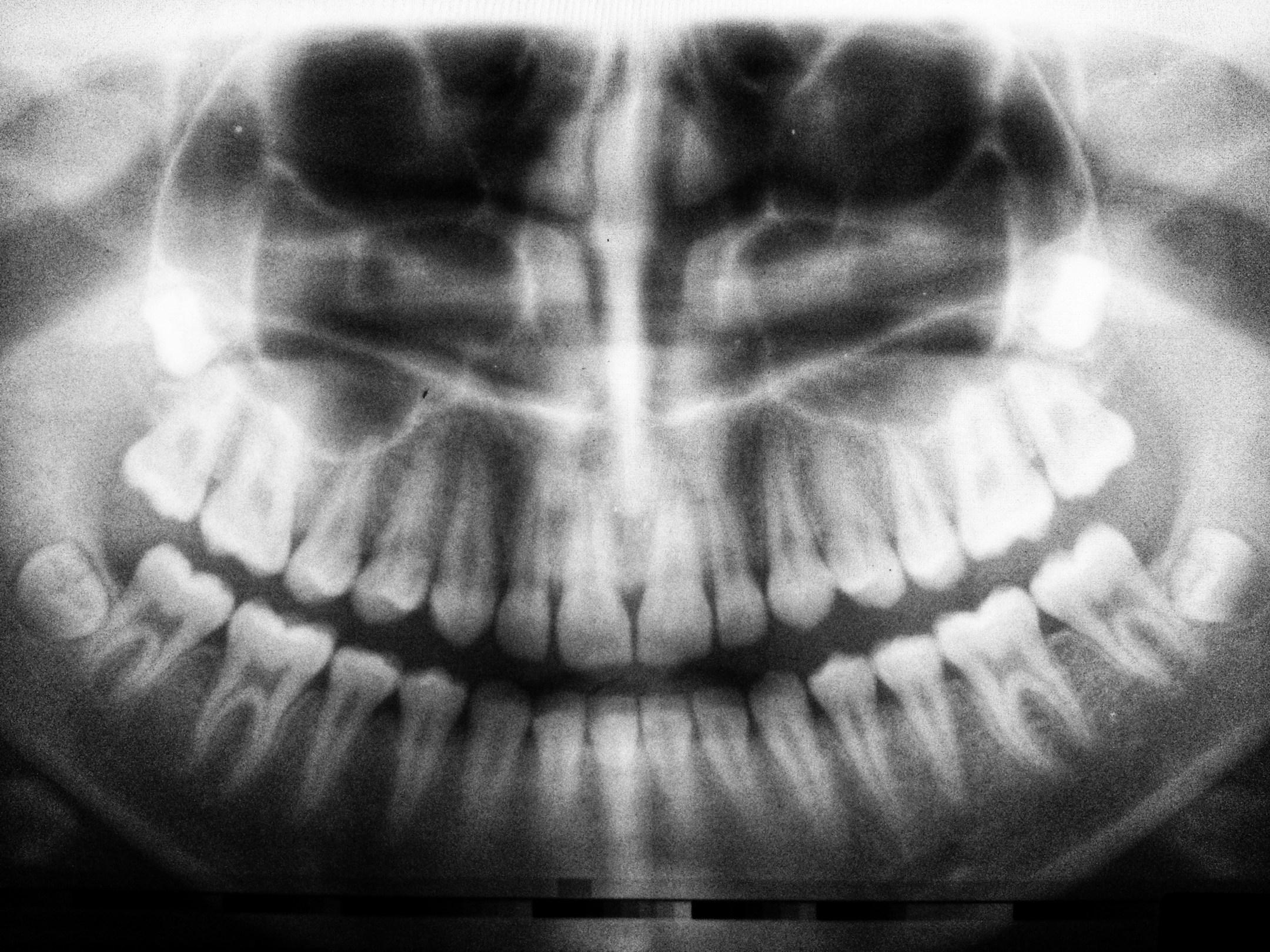 Denti del giudizio,