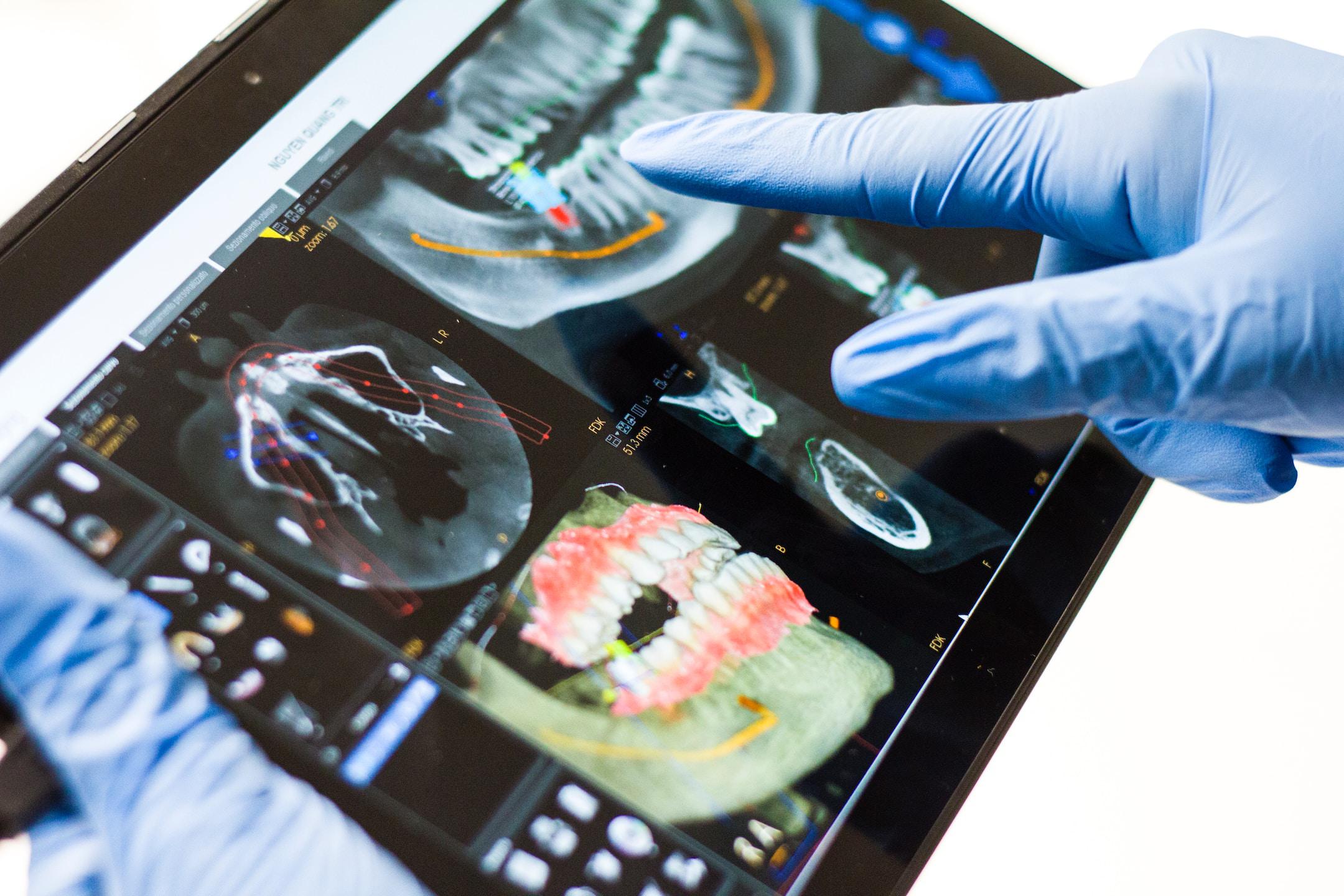 Smart View Pad for Digital Dentist - The New Way To Communicate With The Patient.