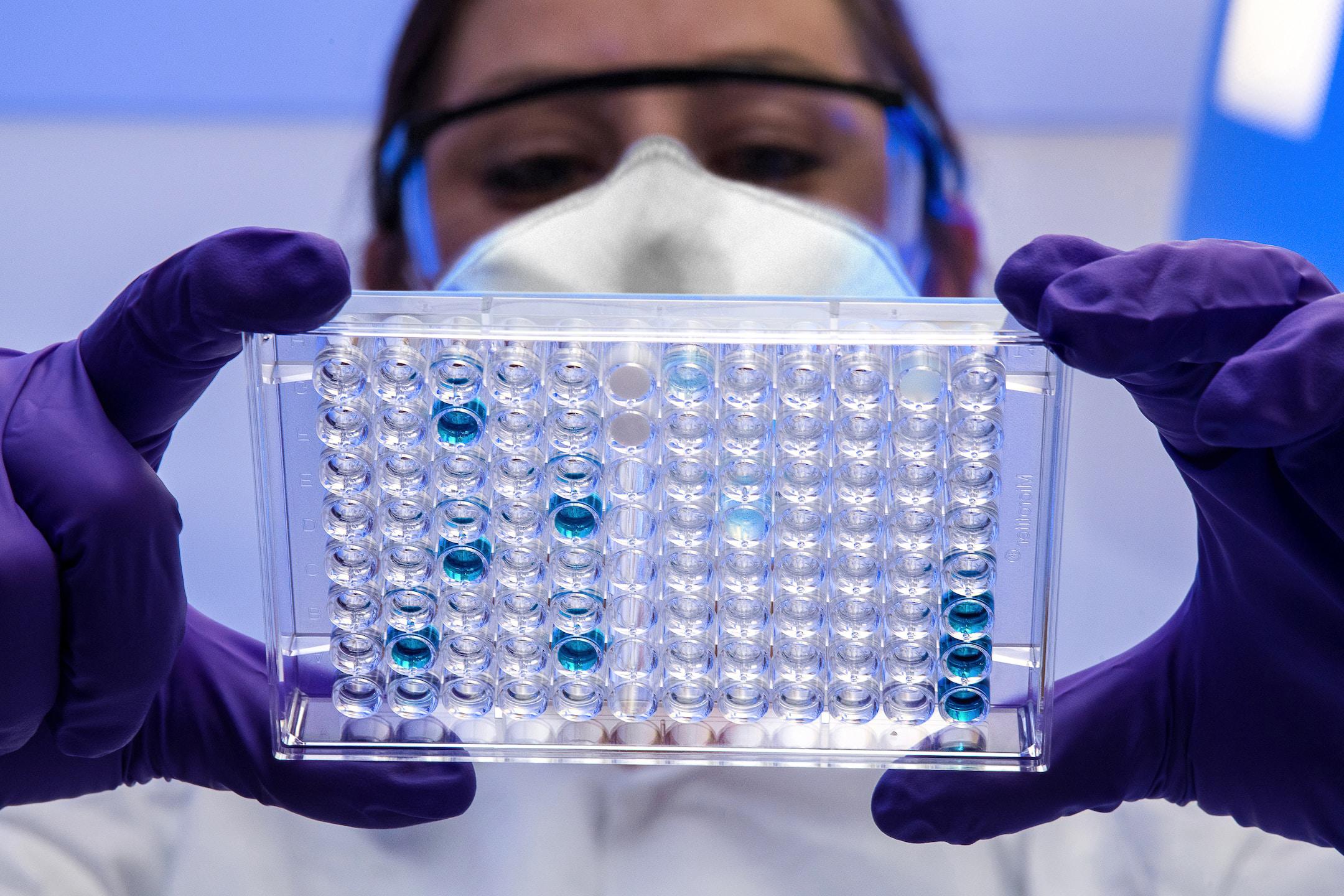 This Centers for Disease Control and Prevention (CDC) scientist was reviewing a plate with serological test samples. Serological testing is used to detect antibodies, which indicate past infection with the virus that causes COVID-19, and is important to the understanding of disease prevalence within a population.