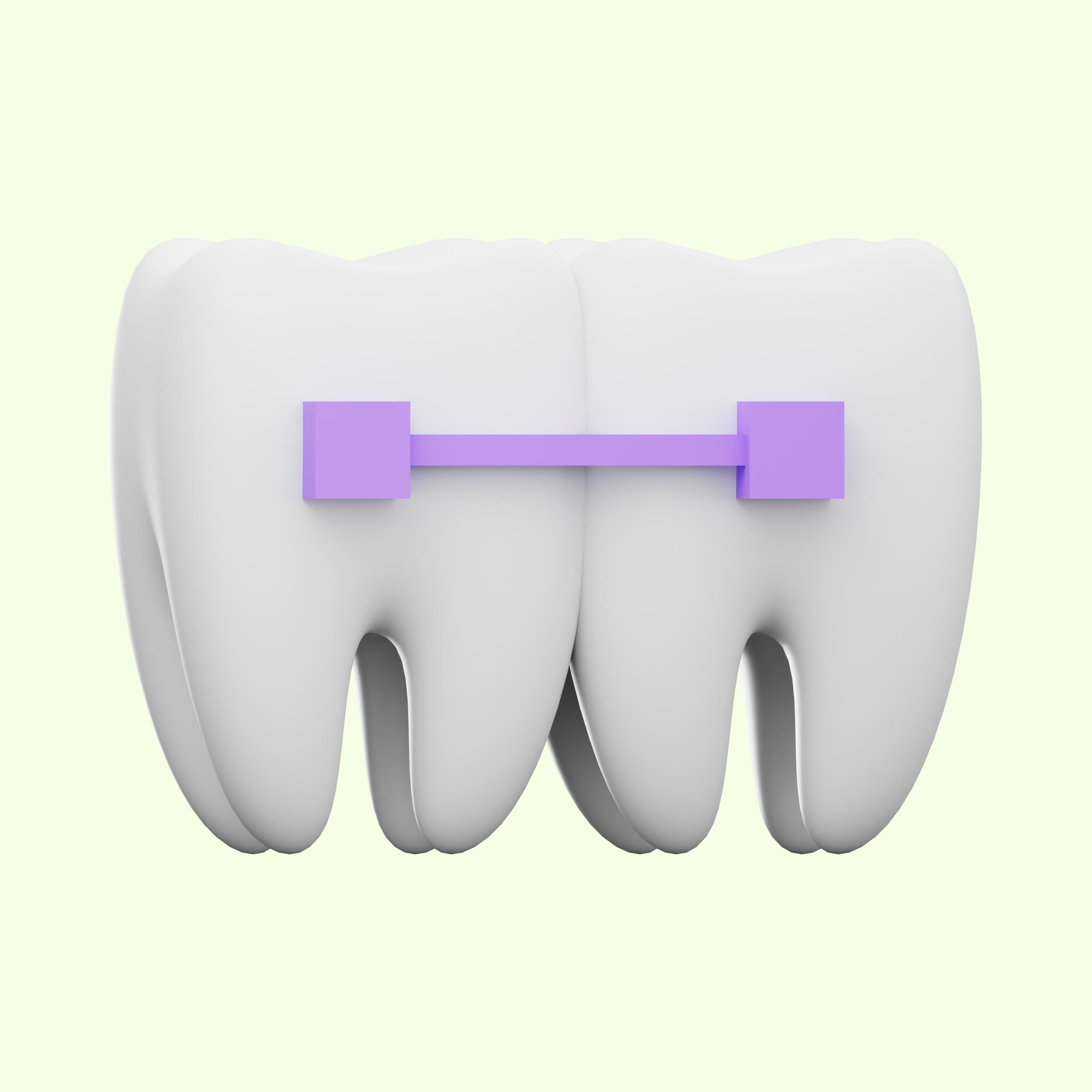 Pediatric space maintainers and habit correction appliances at Kids Tooth Dubai