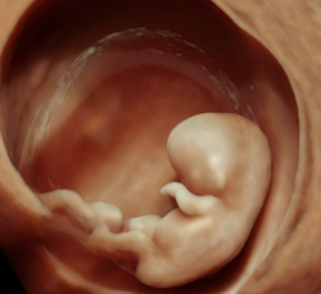 new baby pregnancy clinic