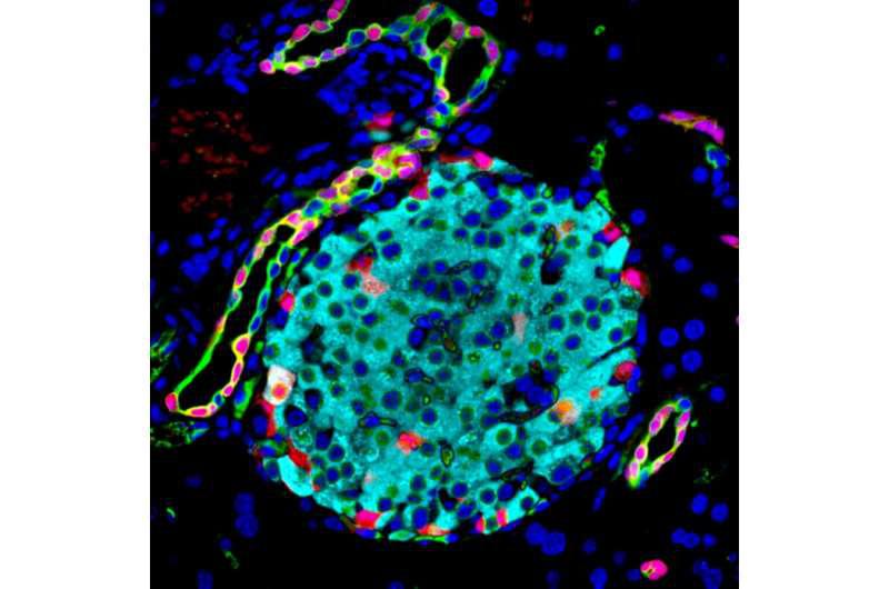 pancreatic-beta-cell-b.jpg