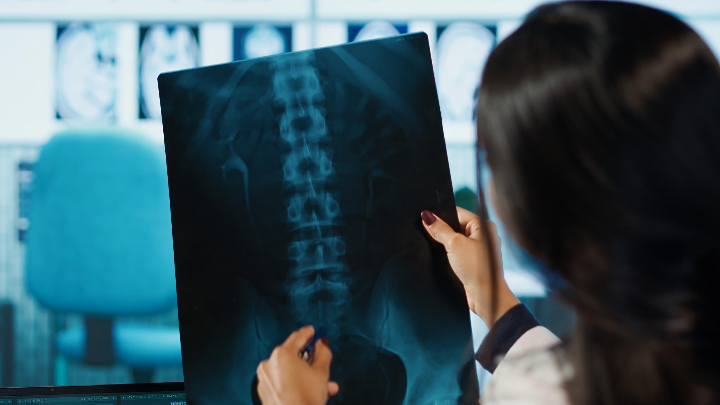 healthcare-professional-examining-x-ray-in-hospita-2026-03-19-02-08-07-utc.jpg