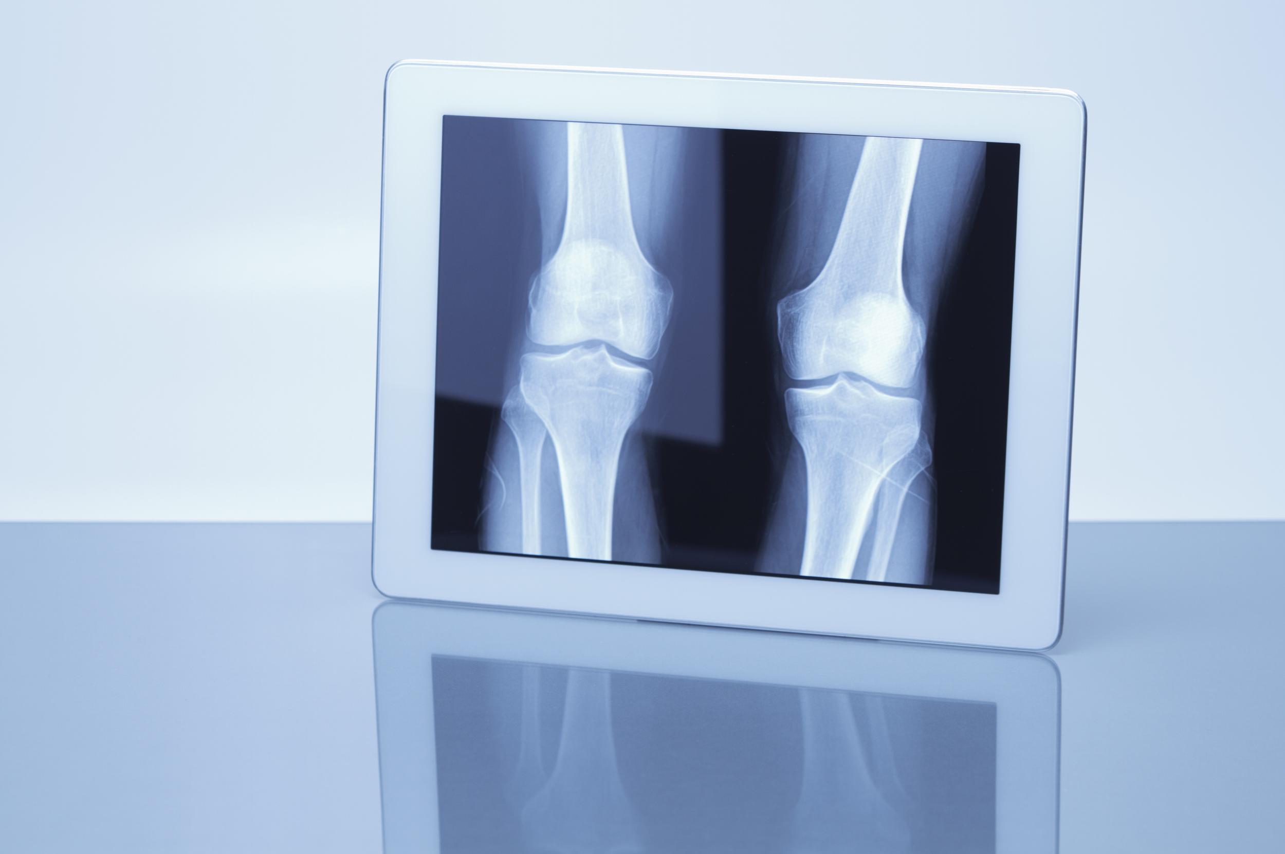 x-ray-on-tablet-screen-for-medical-diagnosis-2026-03-25-00-53-58-utc.jpg