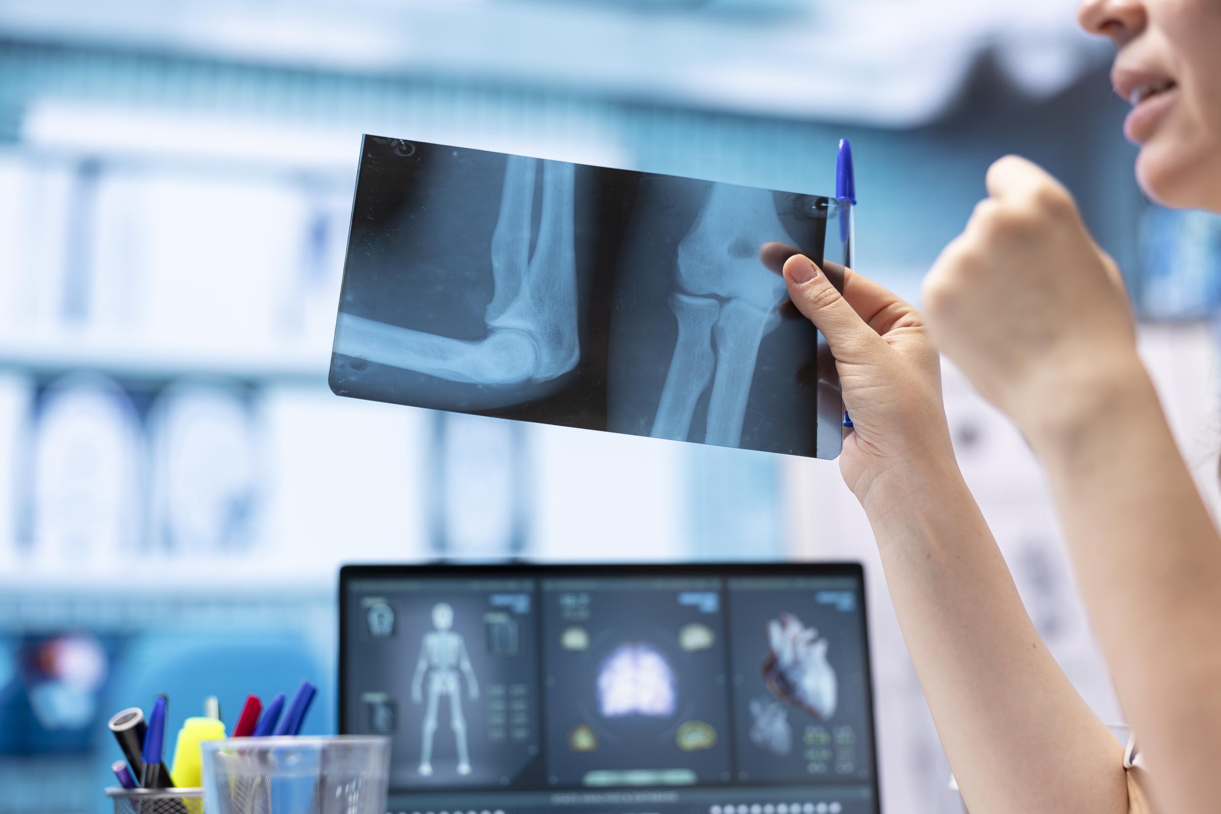 woman-physician-reading-x-ray-diagnostics-for-a-pa-2026-01-11-10-58-47-utc.jpg