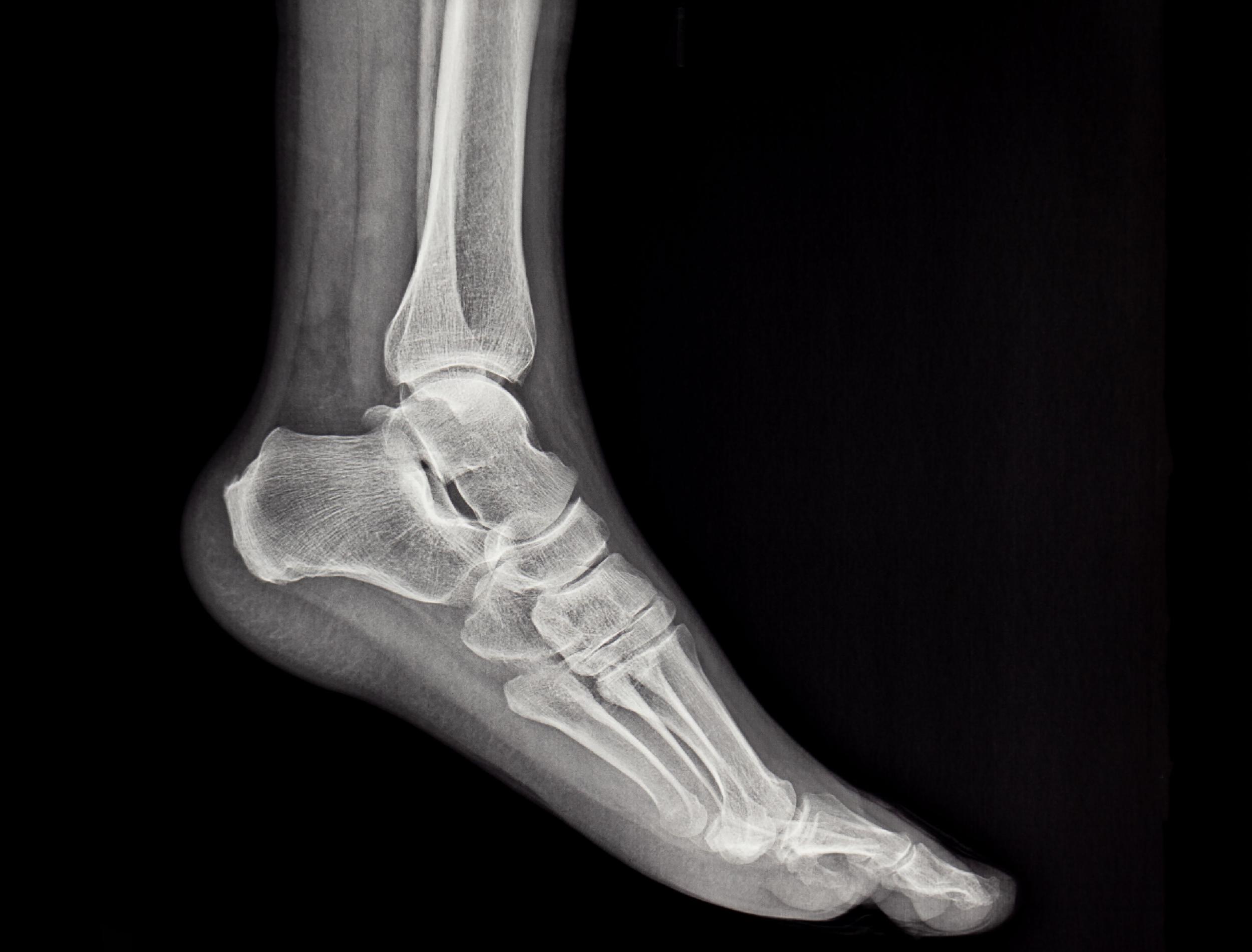 medical-x-ray-showing-foot-and-ankle-anatomy-2026-03-18-05-41-26-utc.jpg