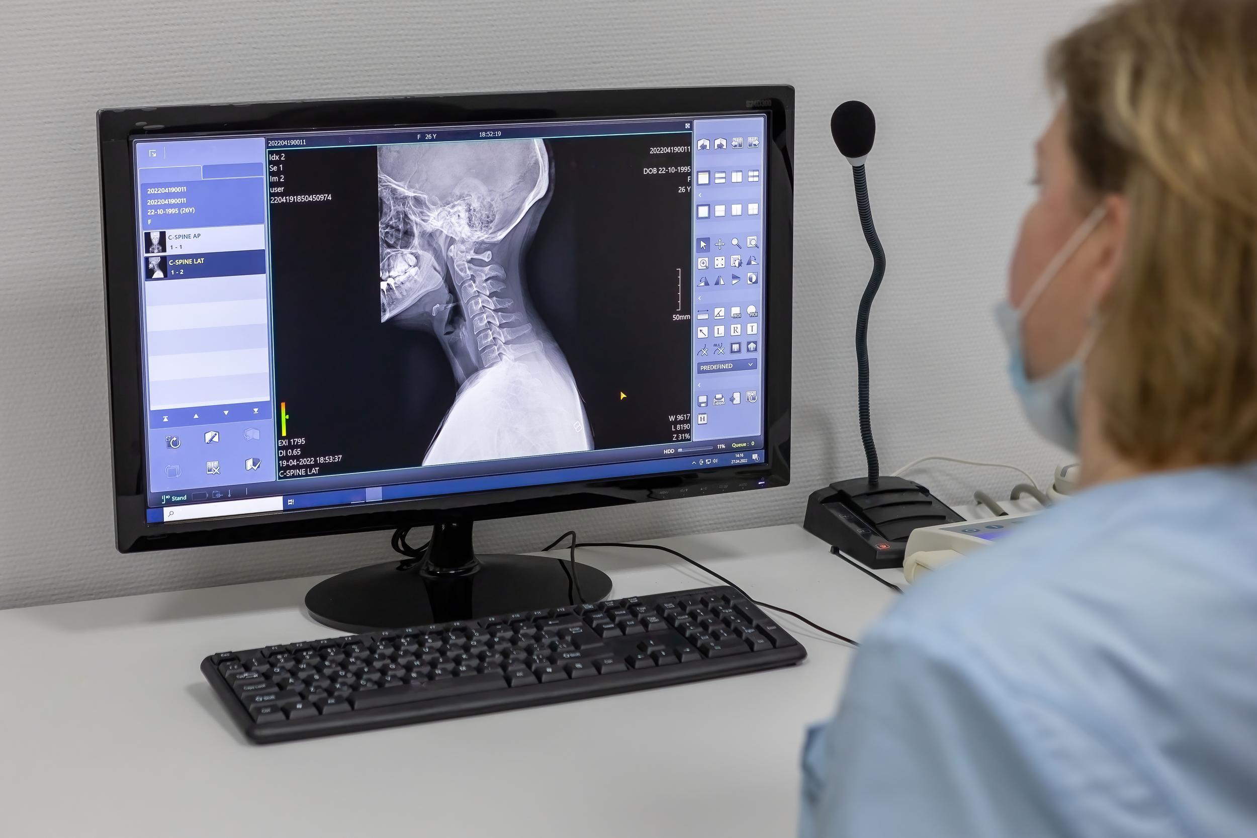 digital-x-ray-of-the-cervical-spine-in-the-clinic-2026-03-13-04-34-09-utc.jpg