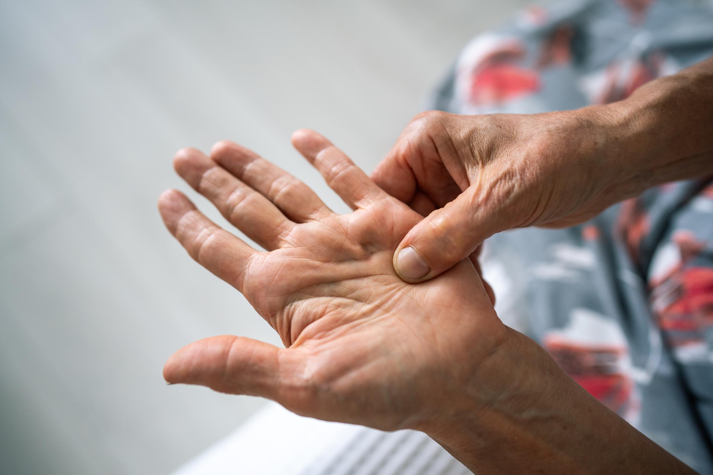 hand-examines-palm-for-injury-or-massage-2026-03-19-23-40-53-utc.jpg