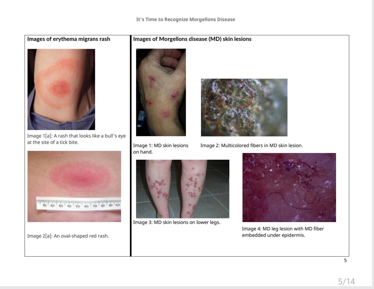 phac morgellons lyme website update05.jpg