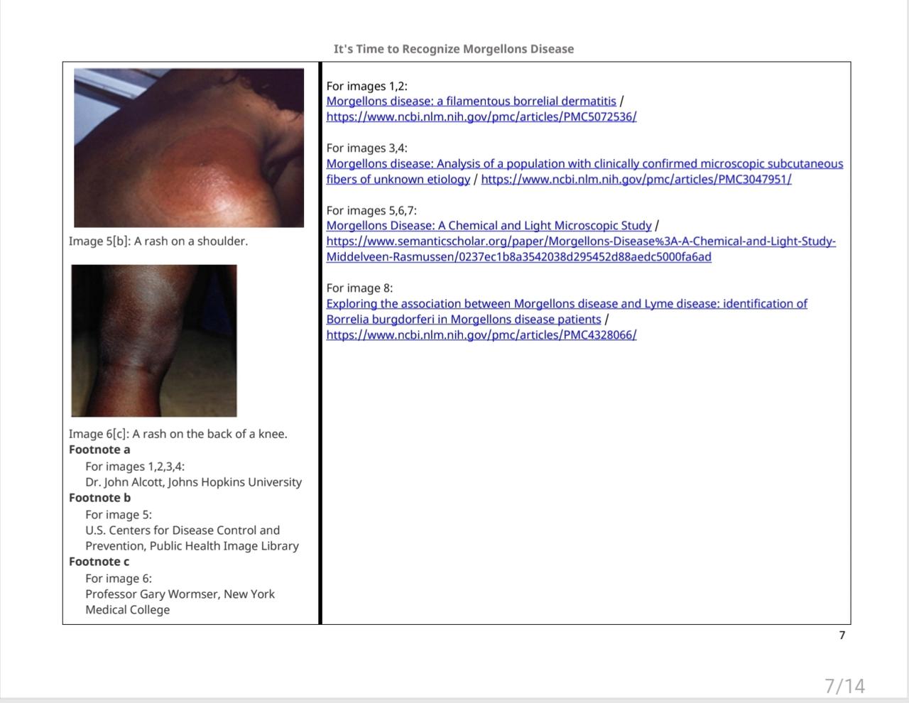 phac morgellons lyme website update07.jpg