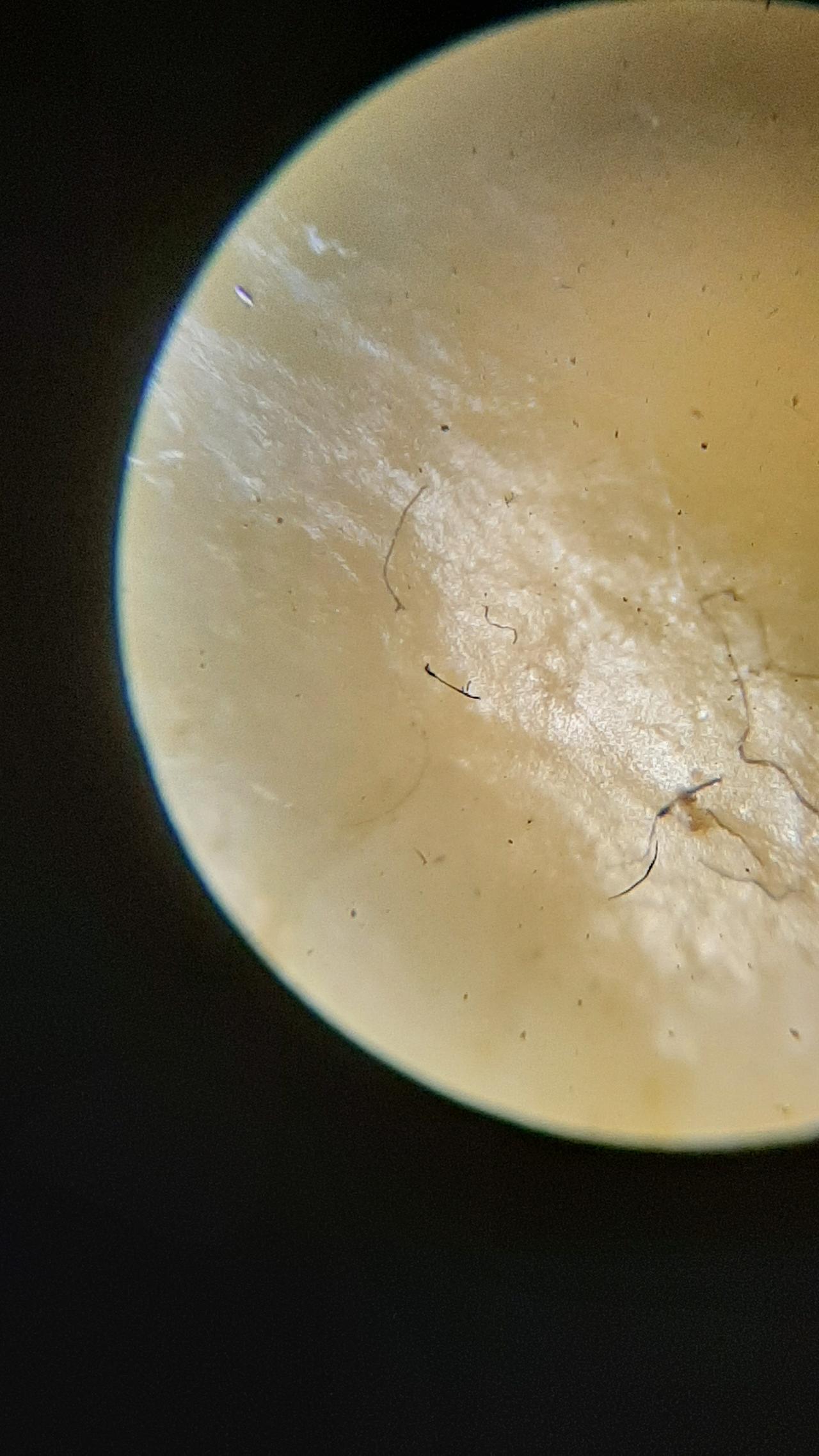 09k - morgellons photo lance teeth.jpg