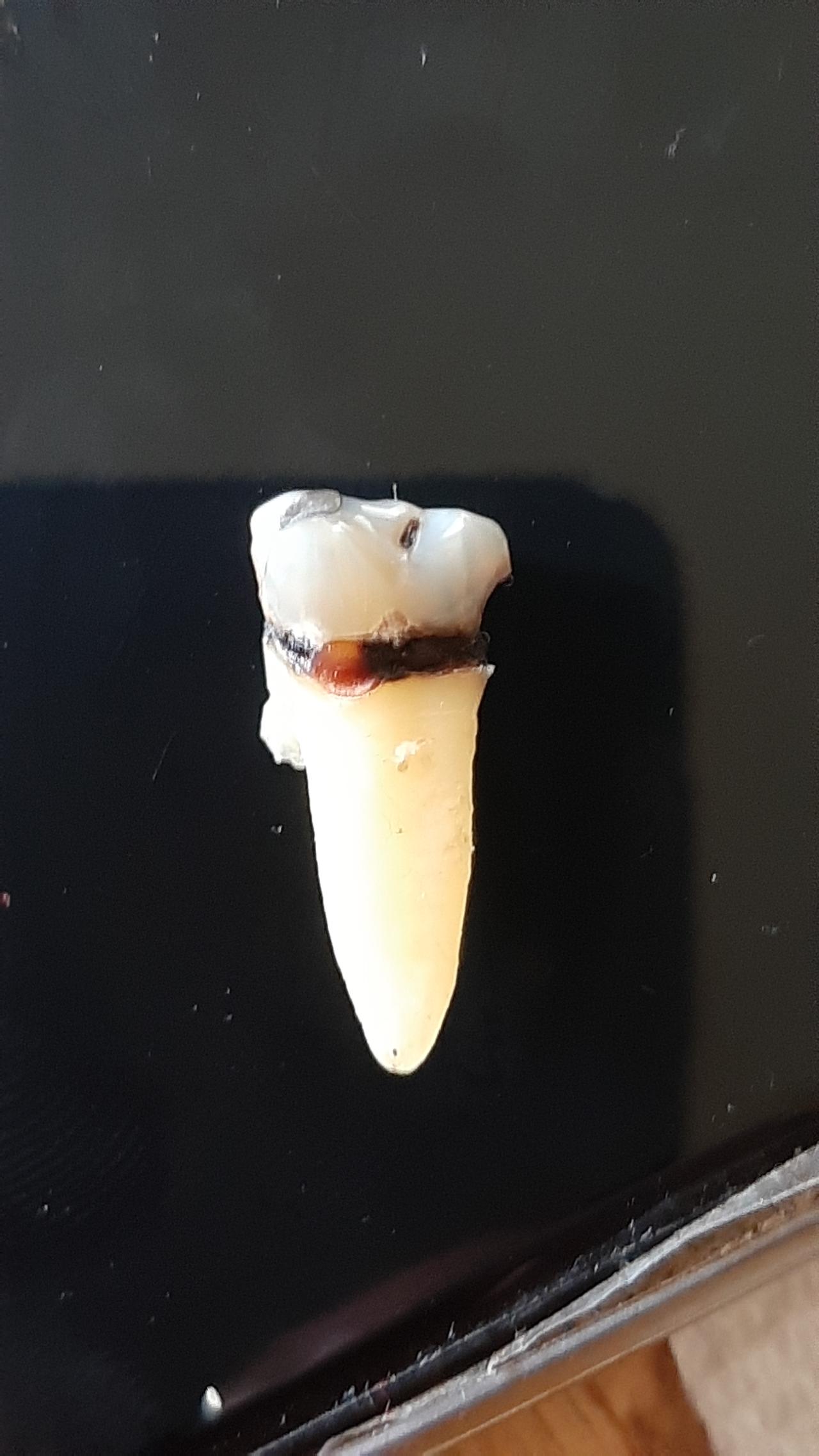 09g - morgellons photo lance teeth.jpg