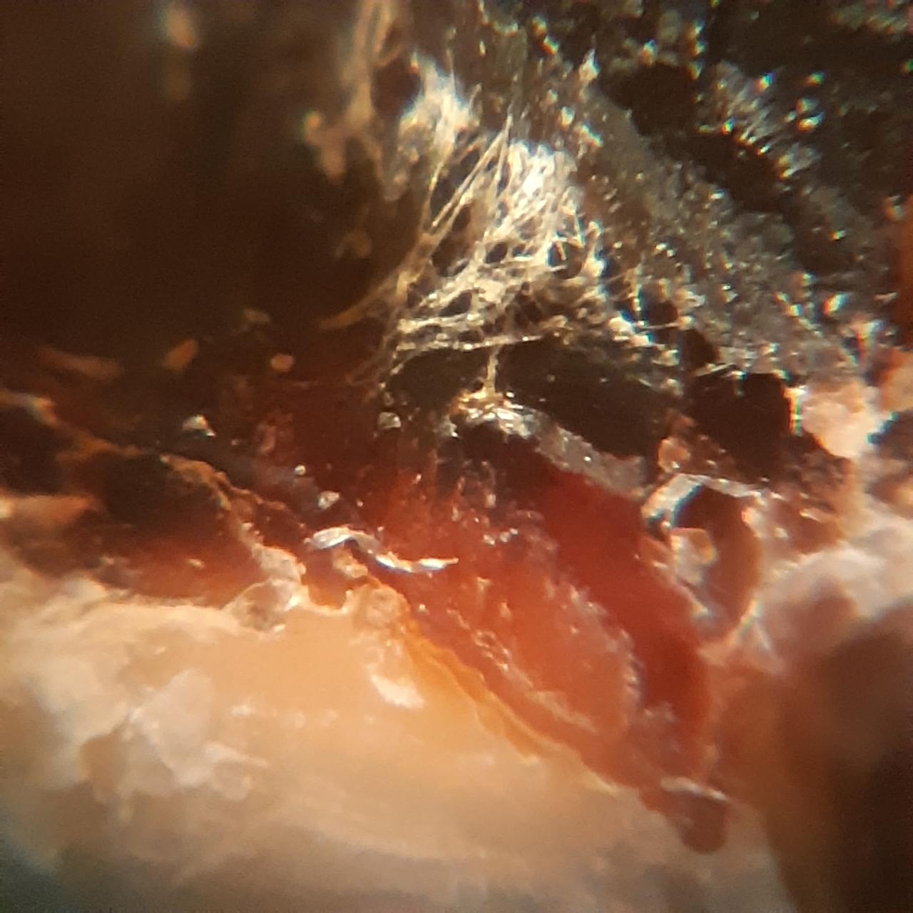 09j - morgellons photo lance teeth.jpg