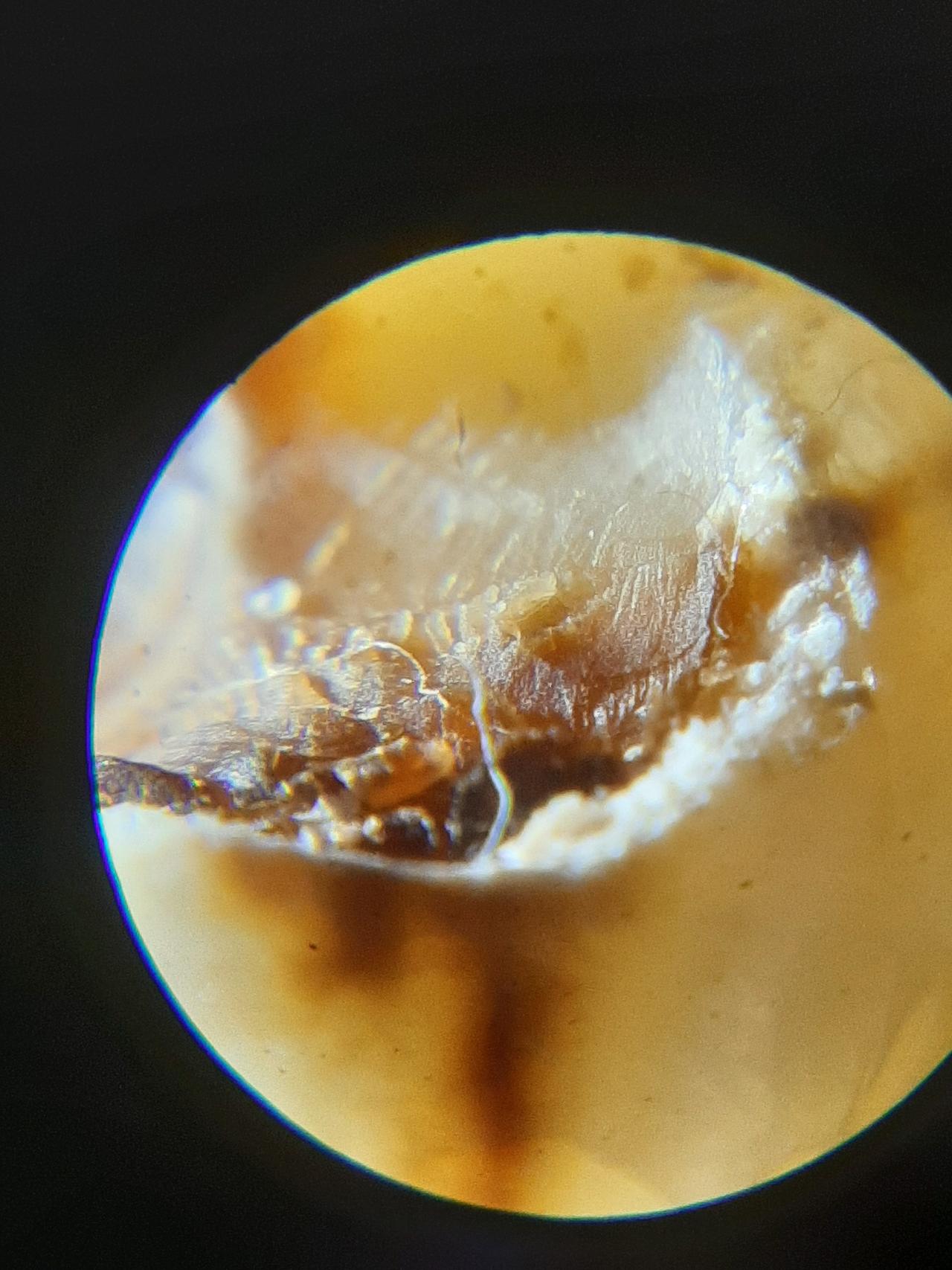 09h - morgellons photo lance teeth.jpg