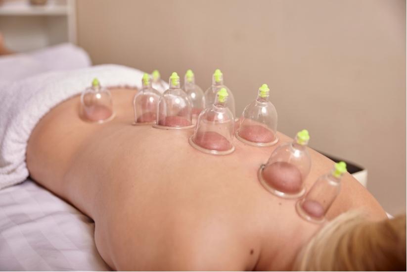 cupping therapy rapha.jpg