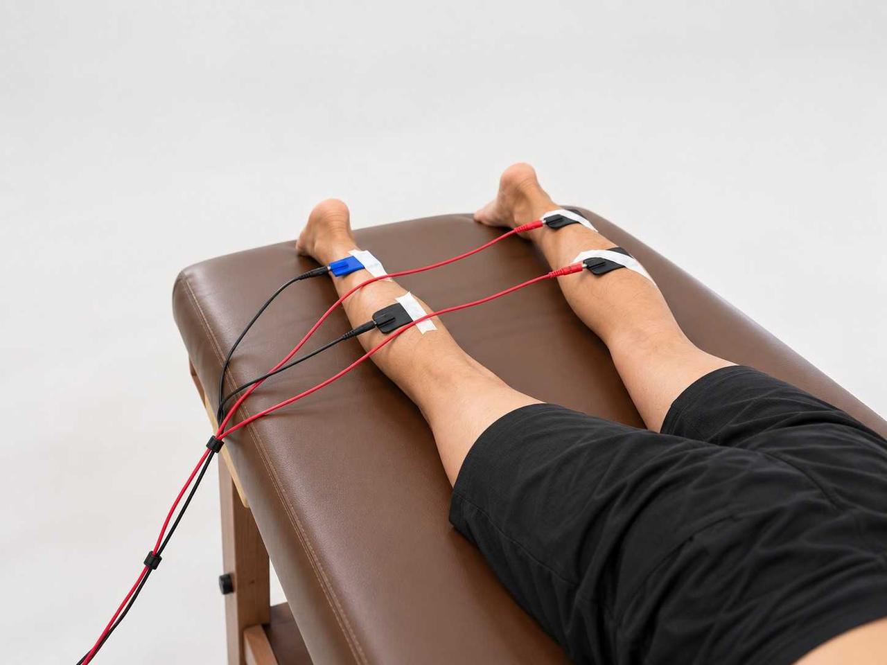Interferential current therapy applied to a patient’s legs in a clinical treatment setting.