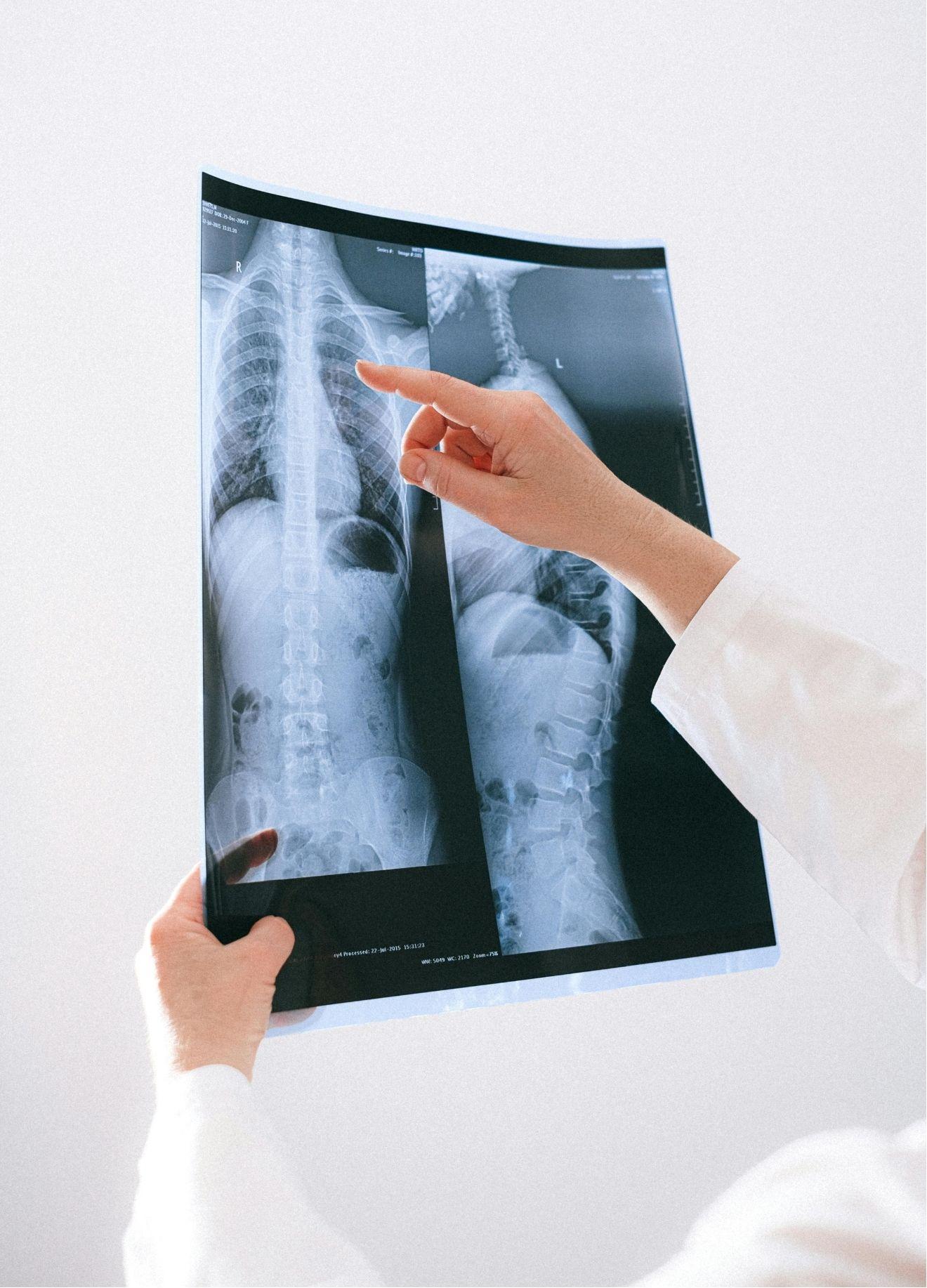 other service-x-ray.jpg