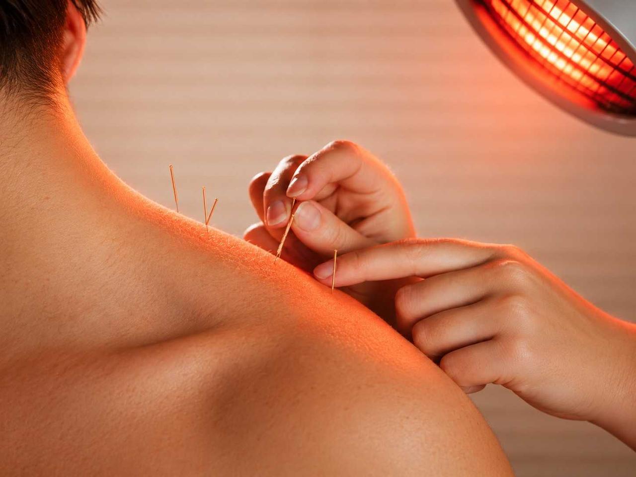 Infrared therapy with acupuncture for pain relief and recovery