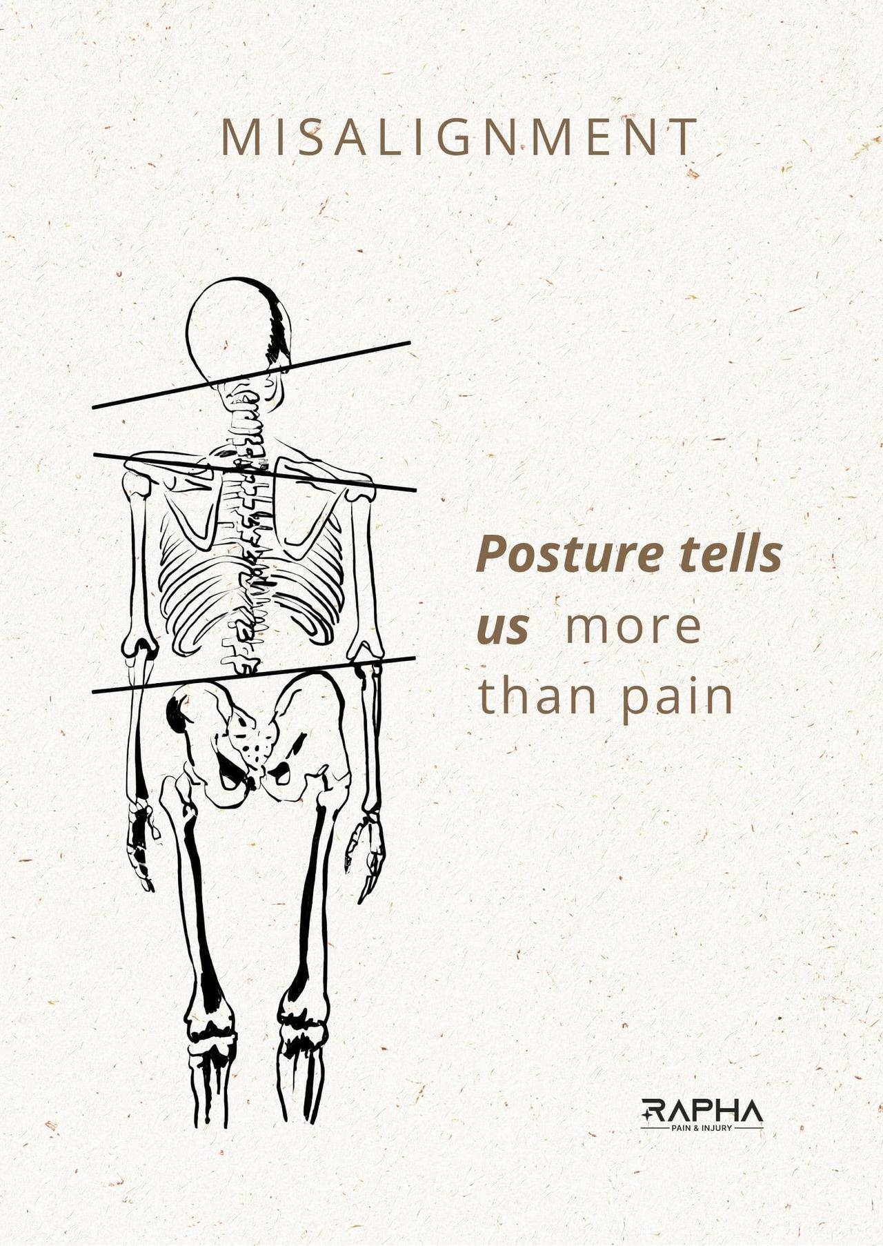 Posture correction illustration showing spinal alignment