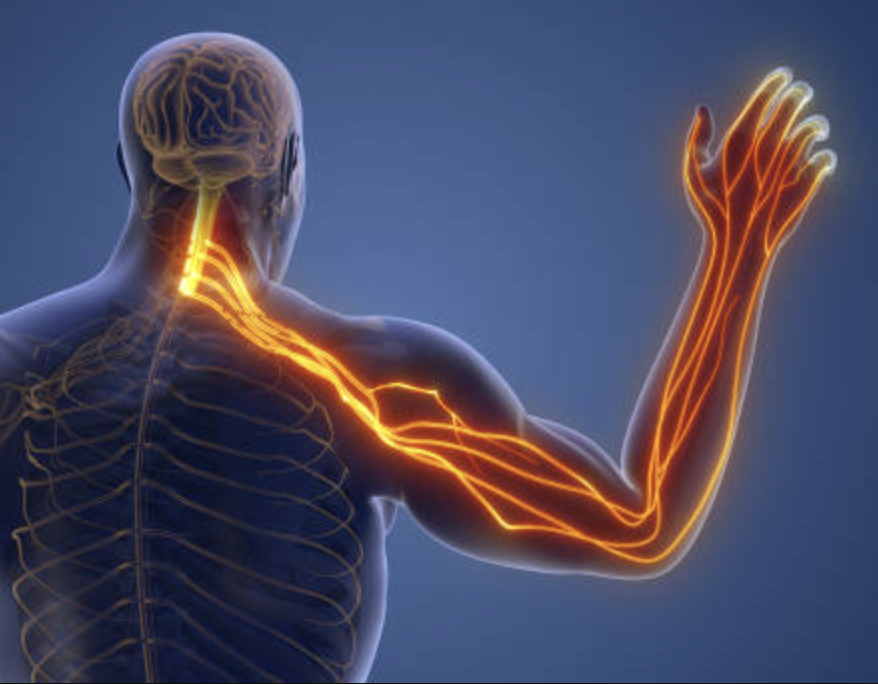 cervical radiculopathy .png