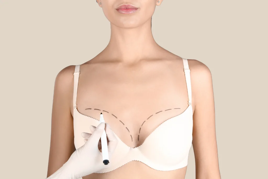 breast-surgery.png.webp