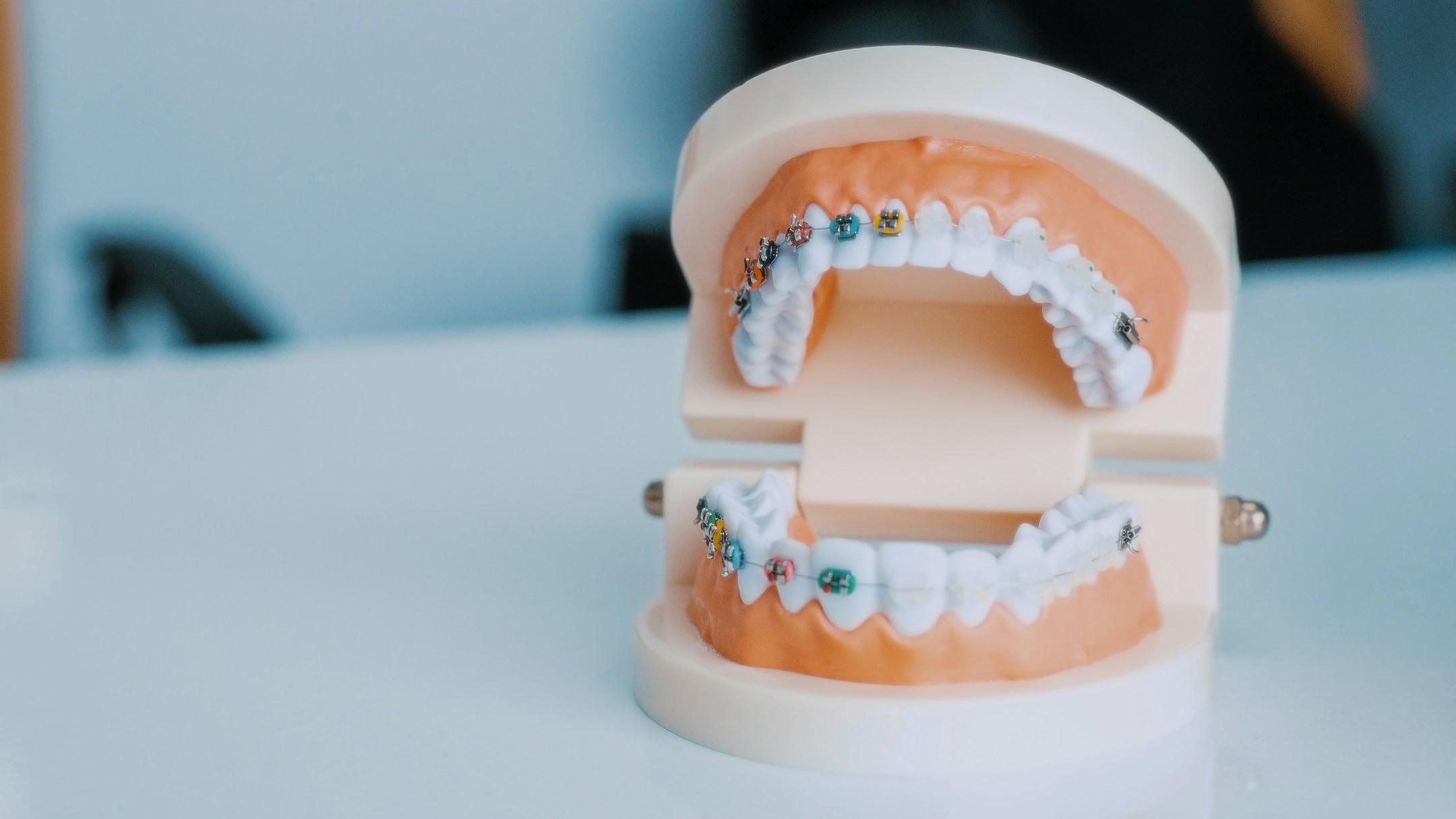 Dental implants