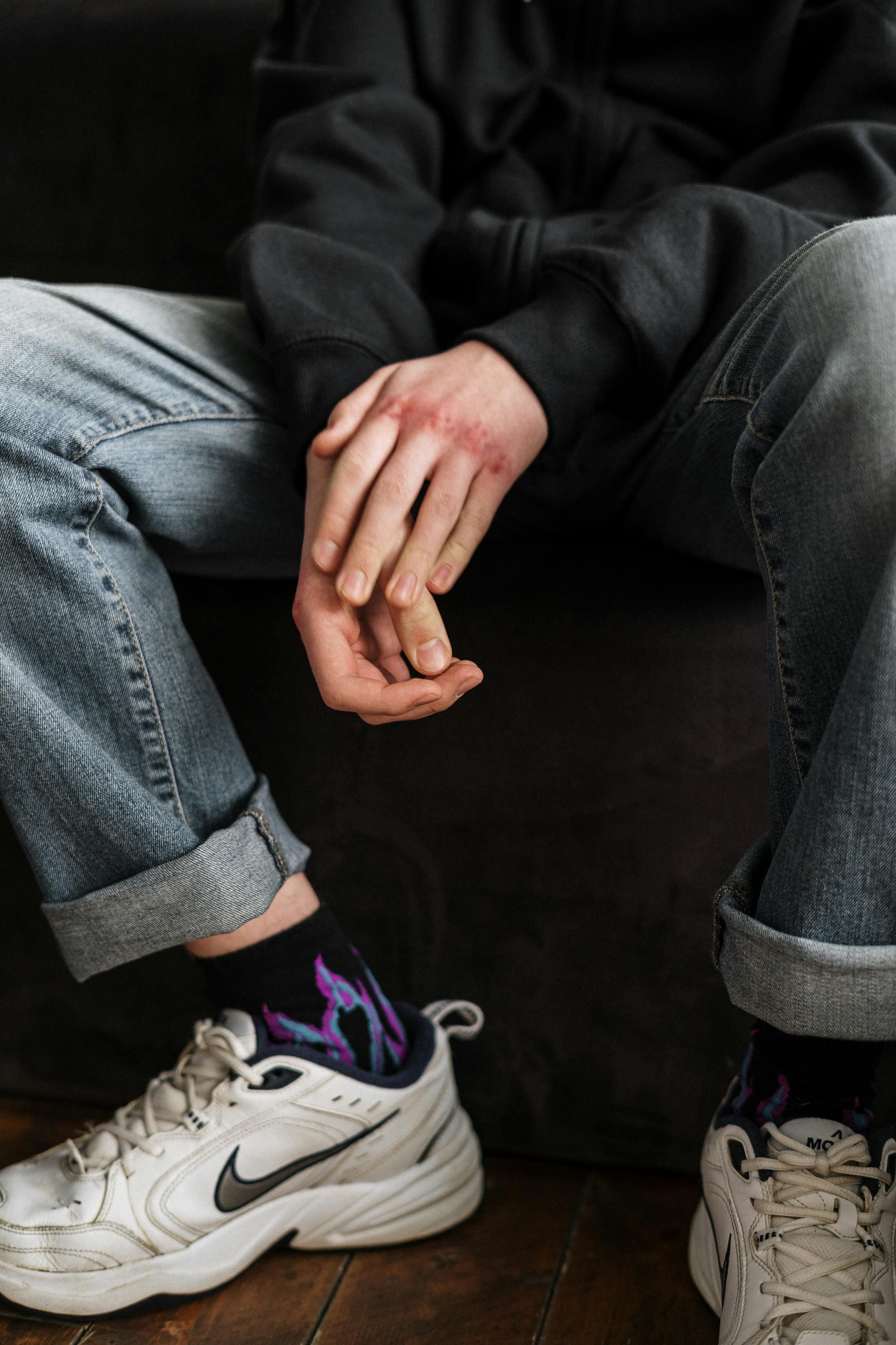 A teenager's folded hands showing injuries, wearing casual jeans and sneakers, sitting indoors.